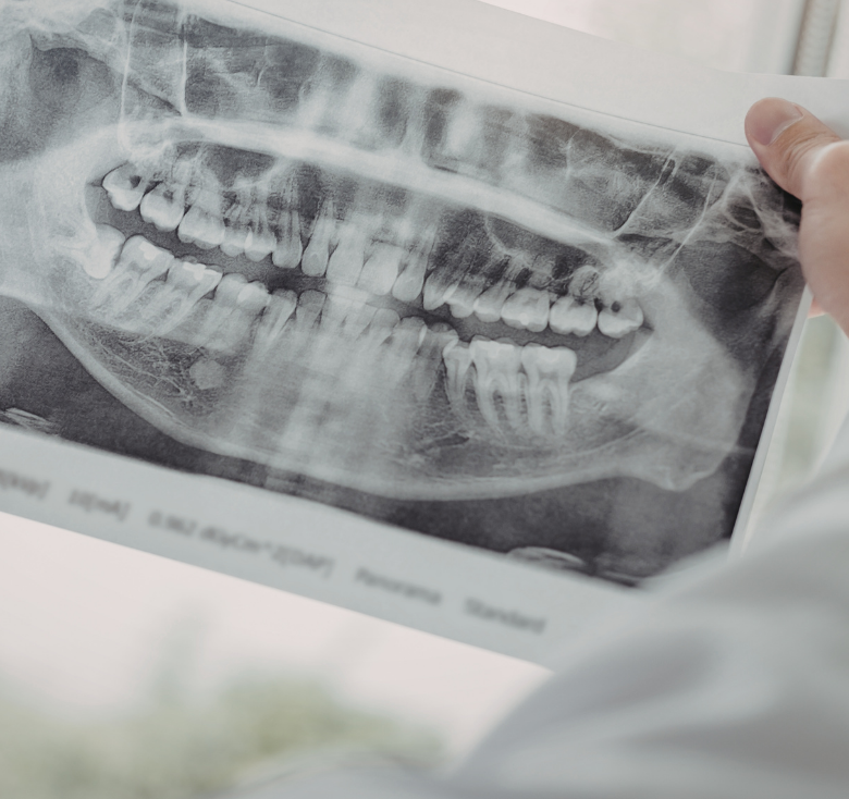 Gentle Tooth Extraction for Kids at Chatham Pediatric Dentistry