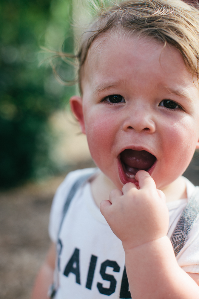 Tongue Tie Treatment (Frenectomy) at Chatham Pediatric Dentistry